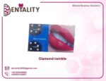 Diamond twinkles